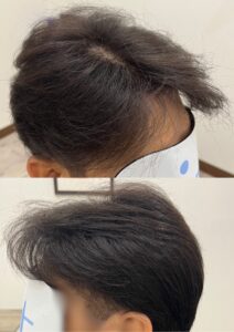 どこから見ても違和感の無いウイッグ